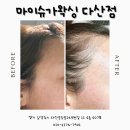 슈가헤어 | 남양주 다산) 인생 첫 왁싱 신이 내린 손놀림 마이슈가왁싱에서 헤어라인 왁싱 후기