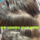 제주시청미용실 큐사랑 소피아점, 3만원의 기적! 제주두피관리 1회 만에 하얀 두피로 환골탈태