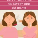 목아플때 목감기 급성인두염 원인과 증상 미리 예방해볼까요 이미지