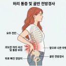 에르고바디 쉐이피코어 V2 장요근 마사지기 후기