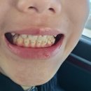 삼성바른아이치과 네이버블로그
