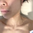 마린성형외과 | [해운대] 센텀시티역 피부관리 청담민에스테틱 피부과도 효과 없었다면 메디 에스테틱 추천