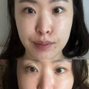 뷰리플한의원 | 안면비대칭교정 잘하는 뷰리플한의원 웨딩관리 솔직후기