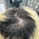 타샵 거절 극손상모 복구뿌리탈색 성공! 끊어짐·얼룩 모발 핑크베이지 염색 후기 | 살롱애뜰