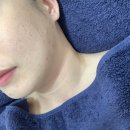 건조한 피부에 생기를, 더나은뷰티 물광수분보습관리 후기