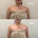 부흥로 | 목포 피부관리 슬아온에스테틱에서 목포 웨딩관리받고 온 솔직 후기