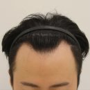 부산 맘모스헤어라인의원 이미지