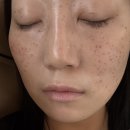 쥬리화장품 - 강릉시 경강로 2194-1 | 광주 진월동 피부관리 추천, 광주기미주근깨 쥬리살롱 멜라올킬 후기