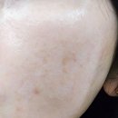 케어라이브 | 달표면크림 메더라이브 리파인크림 후기 오돌토돌 요철 모공케어로 피부결 정돈한 솔직사용기