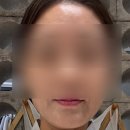 영인의원 | 성남 로얄의원에서 리쥬란 보톡스 피부 관리 받은 솔직 후기