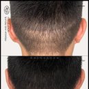 탈모왕 본점 이미지