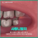 민플란트치과의원 이미지