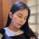 린피부과의원 | [신사동피부과] 울쎄라 인모드 슈링크보다 안아프고 효과좋은 | 린커브리프팅 |