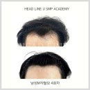 헤드라인유 이미지