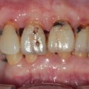 엠웍스 치과기공소 이미지