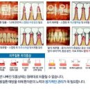 찬스플란트치과의원 이미지
