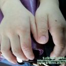 서은옥피부과 네이버블로그