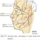 [수정본]삼차신경통, 안면마비, 구안괘사 이미지