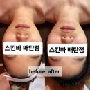 경기도 수원시 영통구 산남로4번길 | 영통 피부관리 수원피부관리 스킨바 매탄점 -기기관리