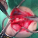 24시 동탄윌 동물의료센터 | 24시 동탄 윌 동물의료센터 - 개의 대퇴골 골절 수복 - 채효준 수의사