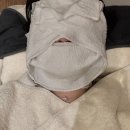 300 | 부산 덕천피부과 울쎄라 300샷 후기 2주차