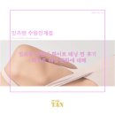 [잇츠탠 수원인계점] 어두운 피부 고민이라면? 탄 피부 복구 화이트 태닝 찐 후기 - 2
