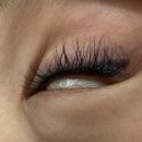 제이유피부과의원 | 아이라인 문신 제거 내돈내산 생생 후기 (사진 왕 많음 주의!!) feat.제이유피부과과