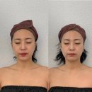 진해 용원 "이븐에스테틱"