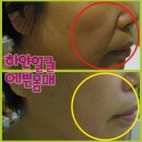 더예쁜피부관리실 네이버블로그