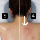 씨유 위례36단지점 | 위례에스테틱 더라인리셋 등 순환 관리 솔직 후기