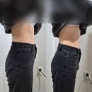 TNT | 부산 서면 TNT 복부 슬리밍 솔직후기[애리서면왁싱 에스테틱]