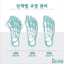 닥터발가락 이미지