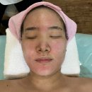트로이빵 | 용봉동 청담스킨앤스파, 용봉동 피부관리 잘하는 곳 트로이필 솔직 후기