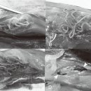 자연산 방어의 골격근 기생 선충류 Philometroides seriolae 이미지