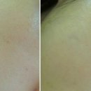 쿨링 여름수분크림 이미지