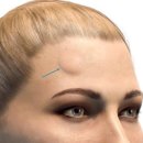 일퍼센트성형외과의원 이미지