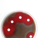 Streptococcus mitis/Streptococcus oralis 이미지