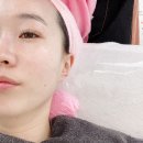 대구피부관리 남구 루즈에스테틱 물톡스 후기