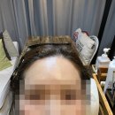 인앤인 | 수원 인계동 왁싱샵 인앤인왁싱, 브라질리언+헤어라인 왁싱 후기