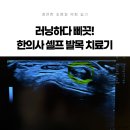 정연한의원 | 동탄 한의사의 러닝 후 발목통증 셀프치료 후기, 발목아플때