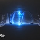 에스에프수정부부치과의원 | 강동구 천호동 투명교정, 기대만큼의 효과를 얻기 위해 알아야 할 점