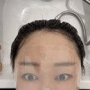 감탄헤드스파 두피클리닉 | 양주헤드스파 아라리움에서 두피클리닉받은 후기