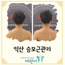 비채길 | 익산 경락 JH윤곽술,승모근 관리 비채뷰티