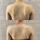 노원피부관리 잘하는 곳 확실한 효과 상계동 아리아뷰티 후기