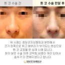 청담흰의원 이미지