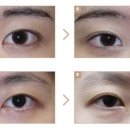 강남미의원 이미지