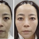 아름다운미탐의원 네이버블로그