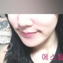 에스탑성형피부 네이버블로그