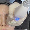 써니 | 여의도피부과 써니리프팅 잘하는곳 턱선 후기