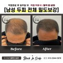 블랙인스칼프 이미지
